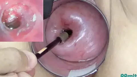 mature milf cervix play with endoscope japanese cam into uterus 1733429110